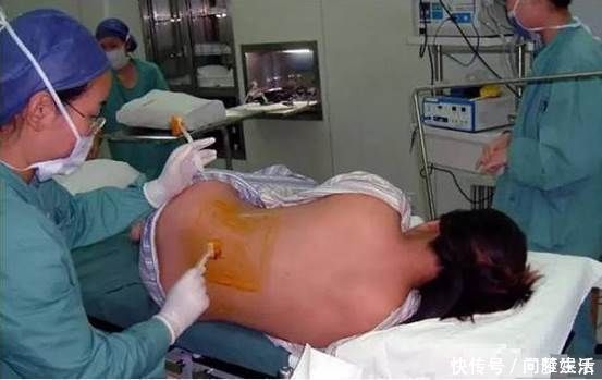 妇产科医生|剖腹产的伤口,对女性身体会不会产生伤害,妇产科医生说出真相