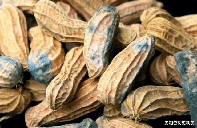 骨質疏松不可以吃雞蛋？骨科大夫：要想骨頭好，這3種食物要少吃