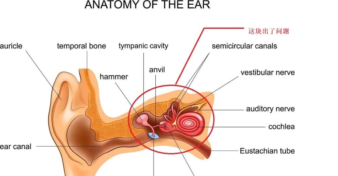 颈椎|女子头晕，以为高血压引起，多次治疗均无效，医生看错科了