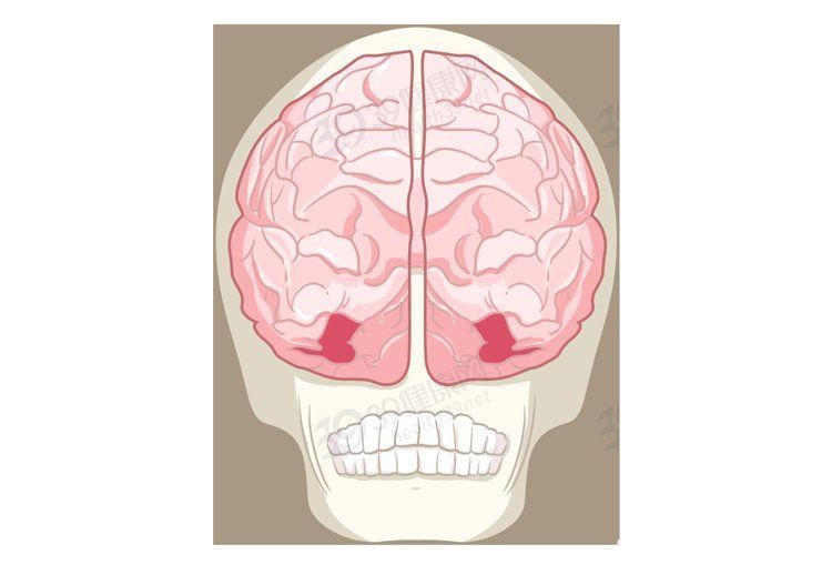 发育不良|“脸盲症”是真的认不出人，还是故意找借口？简单自测一下