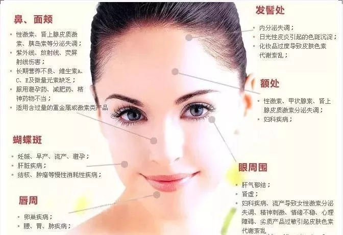 斑点|想祛斑！就要先了解斑是怎么来的！