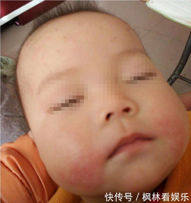 呼吸|孩子每次用嘴呼吸都是在“毁容”,改不掉这坏习惯,只会越长越丑