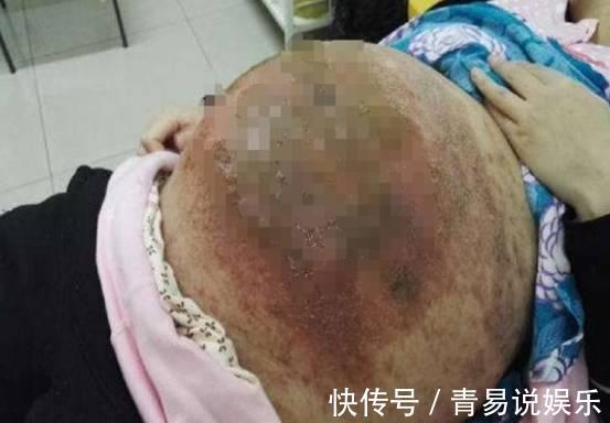 肚子|江苏女子怀二胎没放在心上,8个月肚子太大去产检,大夫早干嘛