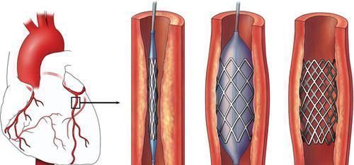 全身|下蹲五分钟,等于步行一小时还能长寿医生教你几种蹲法锻炼全身