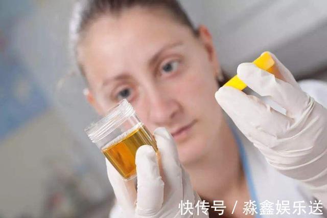 喝水|一喝水尿就多,是肾不好还是在排毒医生提醒3个异常要留心