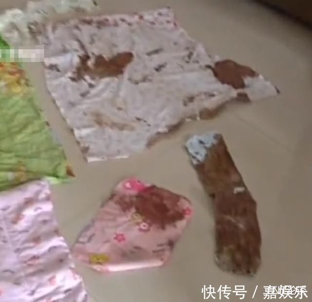 剖腹产|女子剖腹产后孩子尿不湿里全是血,竟是脐带没扎好,医生这是你自己原因