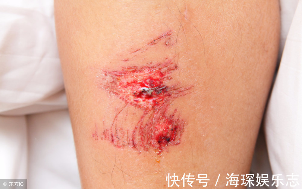 指甲|当身体出现5种状况,基本上都是长寿的征兆,别以为是生病