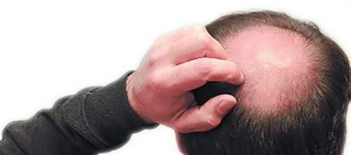 生物节律|男性老不老，不用问年龄，大夫直言：表现一个不占，身体很强