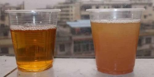 肝脏|李兰娟研究肝病50年，总结出3条“经验”，肝不好的人，建议收藏