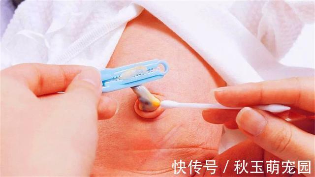 肚子疼!肚脐眼里的“泥”到底是啥?能不能抠?显微镜放大1000倍,真酸爽