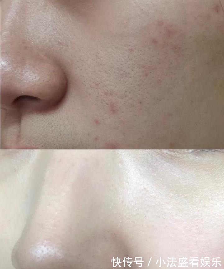 氨基酸洗面奶|把脸打湿,就上洗面奶?做不到“这几点”,别怪毛孔粗大易长痘