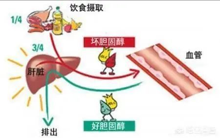 高血脂|为什么每天坚持运动锻炼,可是血脂就是降不下来?医生告诉您实情