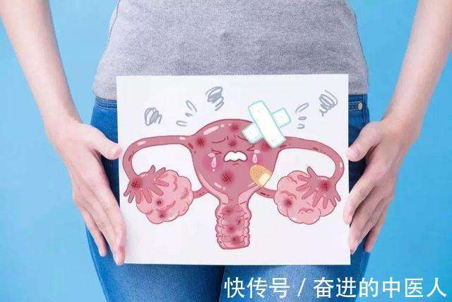 中医肿瘤医院|成都中医肿瘤医院,成都中医肿瘤研究院:中医保守方案诊治卵巢癌,缓解患者症状