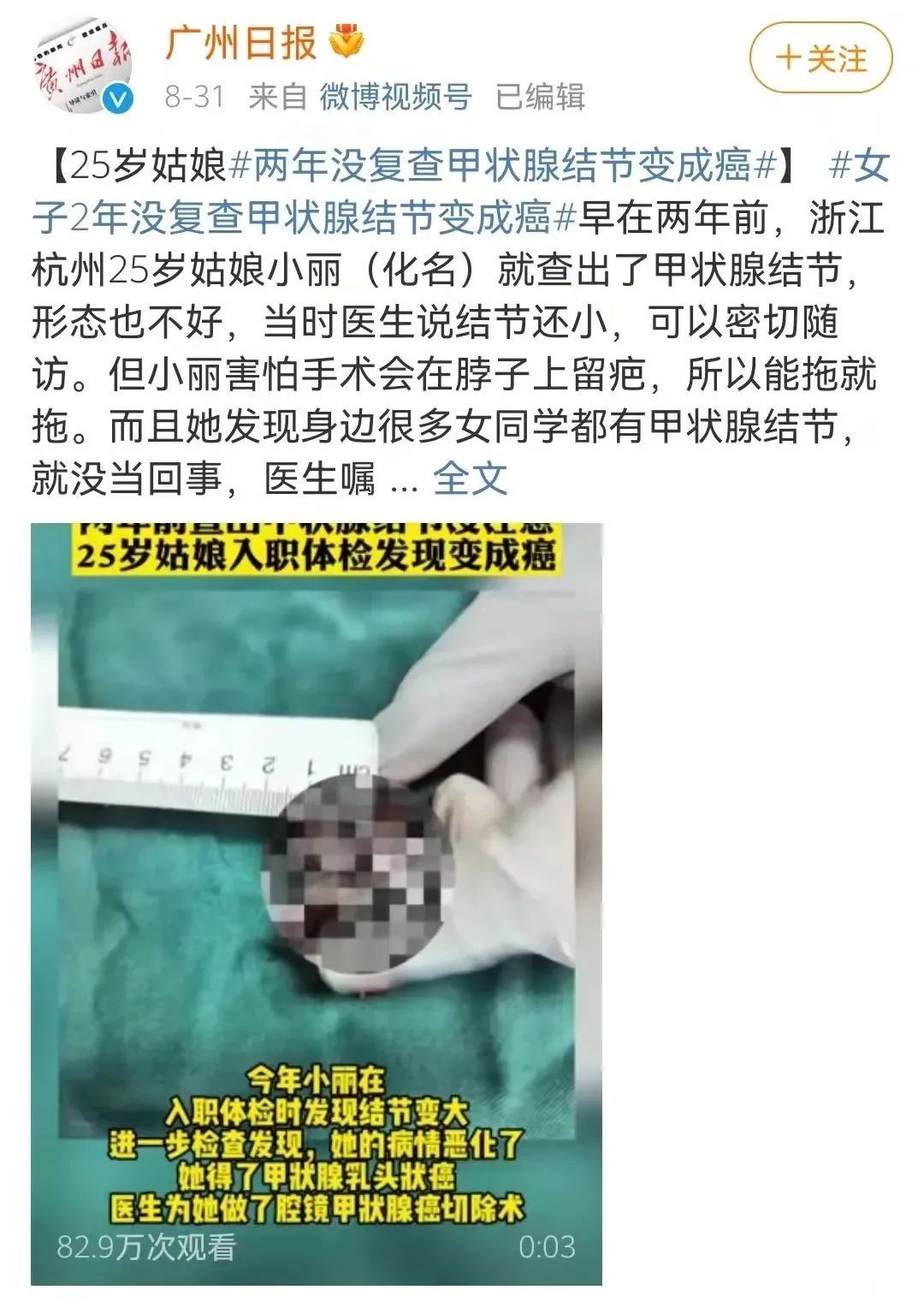 复发|查出这类结节、息肉，再小也别忽视！中医平肝健脾，消结节、除息肉，化解肿瘤危机防复发