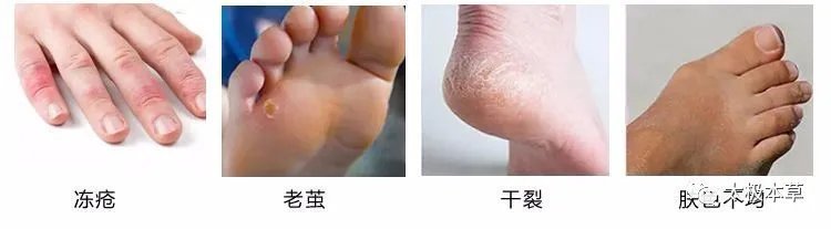 调匀|手脚出现的小毛病,用简易良方,原料易得,收藏吧·