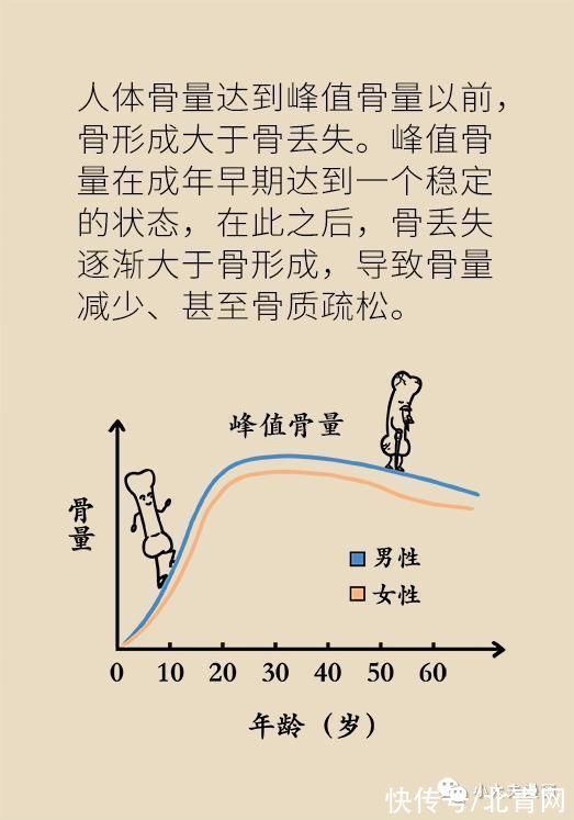 骨量|怕骨折，去补钙，会补出肾结石吗？骨量减少应该这么解决