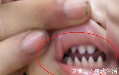 牙齿|2岁宝宝长出一口“鲨鱼牙”,宝妈痛哭求助,医生无奈:自作自受