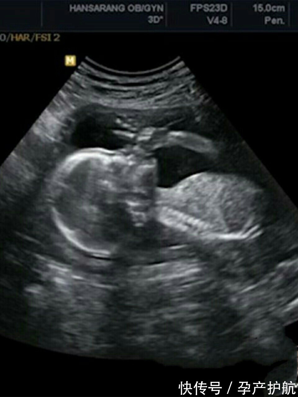 孕期|顺产男宝，儿子好萌，可爱的金牛宝宝呀～