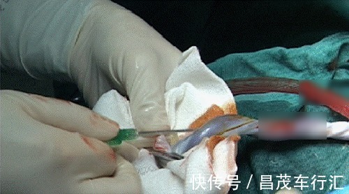 孩子|脐带血=救命血?伴随孩子降生的这份“礼物”,到底要不要留存?