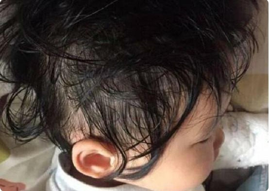 晚餐|吃1次等于吃10个塑料袋,7岁男童积食不长个,只因“毒晚餐”