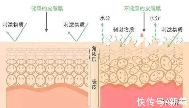 医美 从护肤到轻医美，敏感肌到底该怎么做？