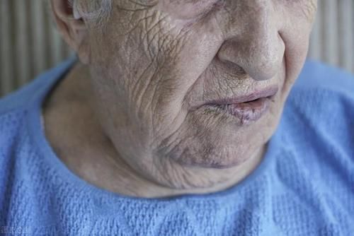 止痛|附子=有毒不能用？中医告诉你白附子的3大妙用