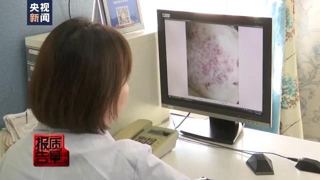 ph值 女生们注意了！刷酸真的有用吗？小心“毁容”……