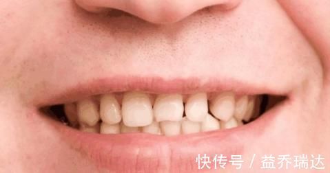 妇科病|女人有妇科病,嘴巴会提前知道,若有此4种表现,不可忽视