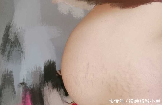 胎儿在宫内妊娠发育|“过了早孕期，为何还会胎停育”孕期如何预防胎停