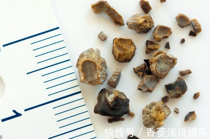 儿子|母子二人先后查出胃癌,丈夫痛哭,专家:很多家庭常犯的错!