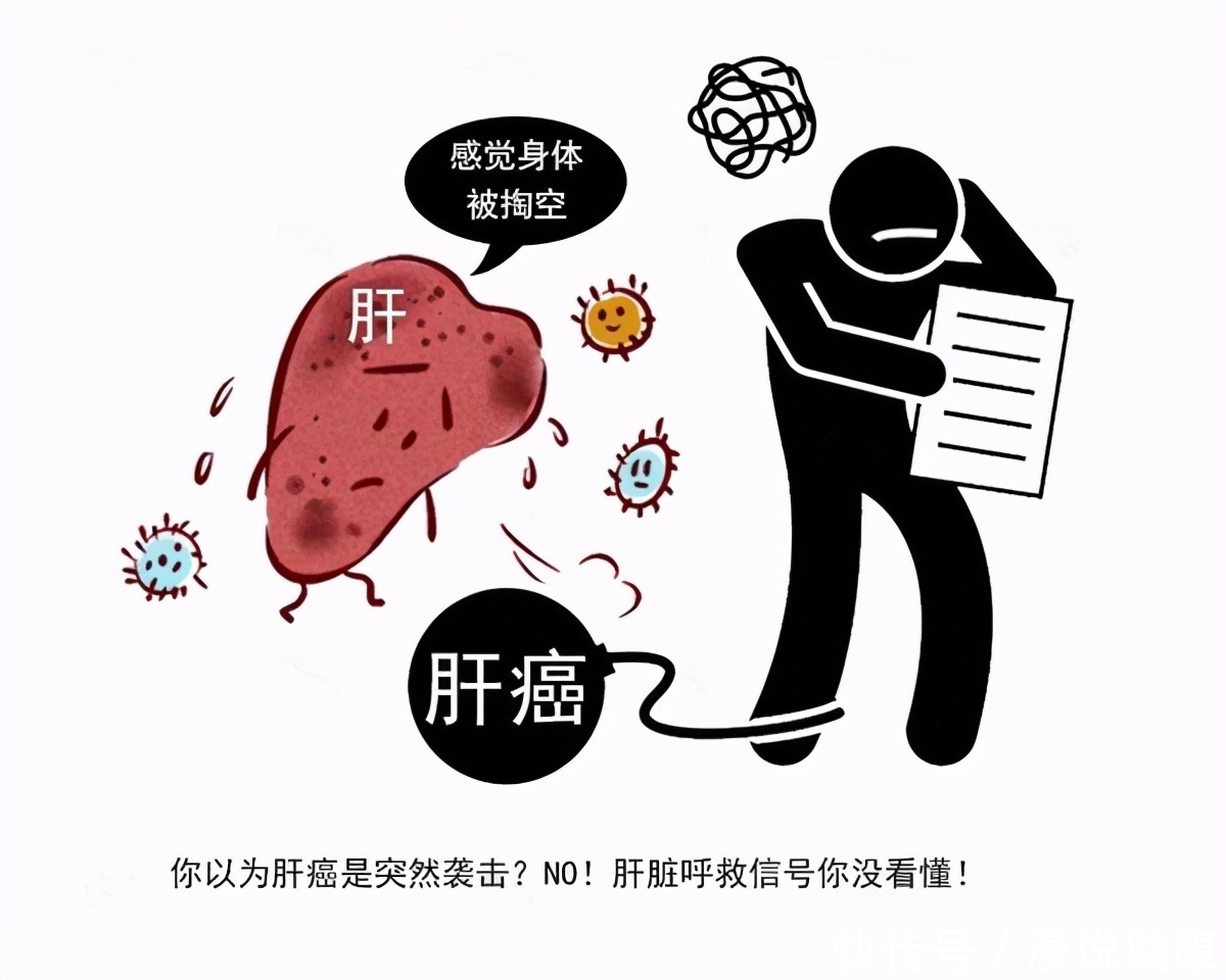 癌细胞|肝癌并非毫无征兆,身体若有“2黑2臭”,医生建议你早点检查肝脏