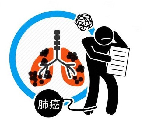 癌变|肺癌一发现就是晚期?早期3个信号并不难发现,可惜很多人不懂