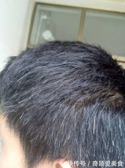 健康|长白头发，对我们健康来说是一件好事吗？听听哈佛大学研究怎么说