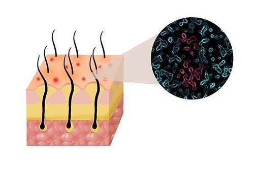一挠头皮，指甲缝中都是白泥？医生：可能不是头皮屑，要上点心