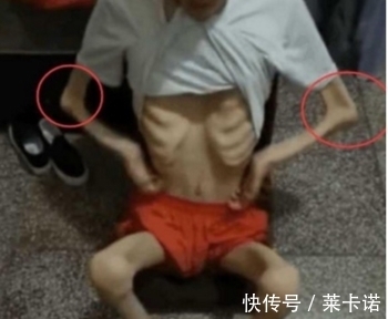 检查|17岁男孩瘦到40斤,去医院检查没病,他含泪道出事情真相