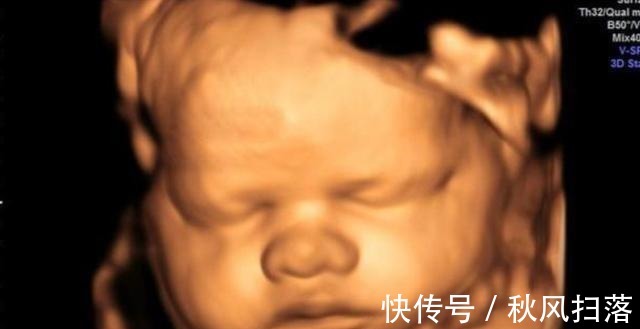 算数|“天才”胎儿走红,还在妈妈肚里就会“算数”,医生清华北大等你