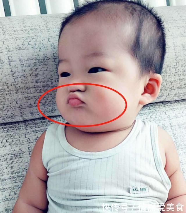 莎莎|1岁儿子总撅“金鱼嘴”,妈妈还在夸可爱,奶奶掰开嘴后直奔医院