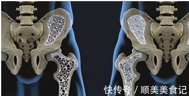 茶叶|中国人的3个喝茶习惯,正在毁掉我们的肾和胃,看看你中了几个?