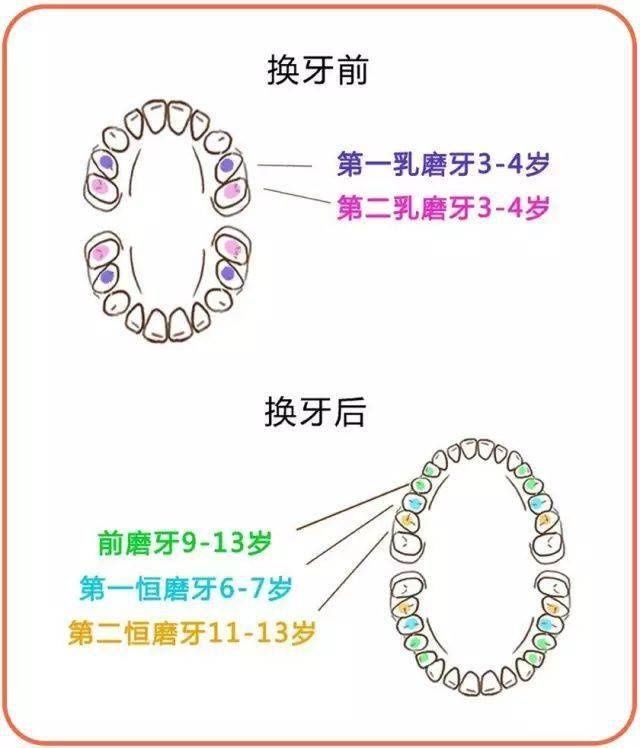 图文来源网络|涂氟、窝沟封闭——孩子牙齿的保护衣