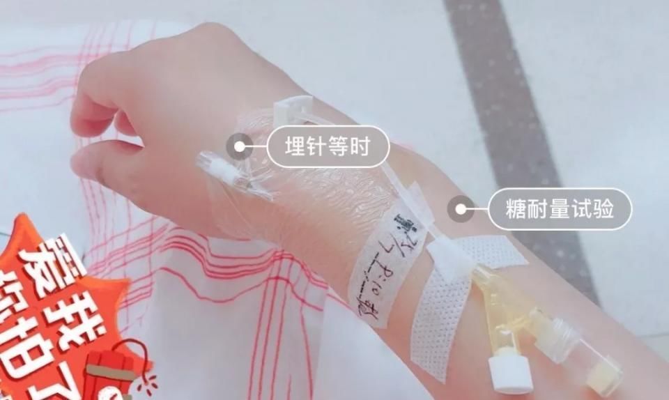 检查|提前1周调整饮食,喝完糖水后多走动,糖耐检测你“作弊”了吗?