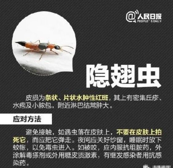 隐翅虫|又是它!女子半夜关灯玩手机,险些致毁容……