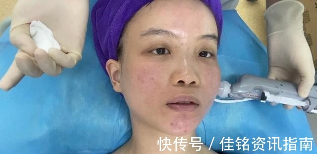 水光针 适合长期做的医美项目,你知道么!