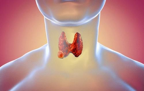 不良习惯|53岁阿姨，甲状腺结节转癌，医生怒斥：一把年纪怎能如此放纵