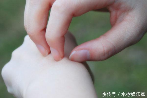 女友半夜全身瘙痒,原因找到!医生:幸好男子没碰