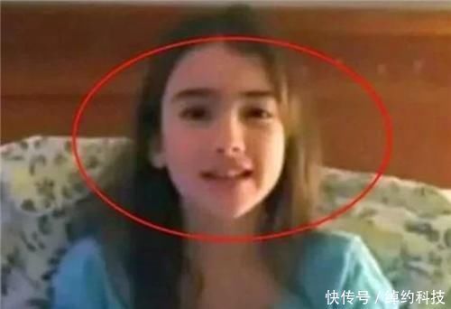 早产儿|18年了,那个出生仅280克的女婴,曾打破世界纪录,如今还活着