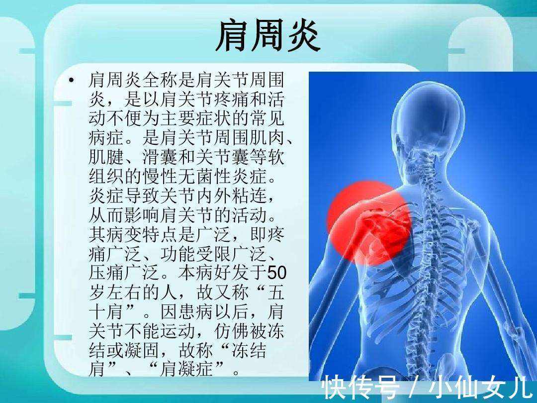 骨伤科|骨伤科教授王飞说，知道你的肩周炎是怎么来的吗