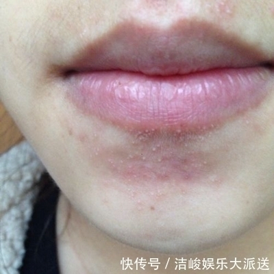 杜仲杜仲|血液黏稠的人,看嘴就知道!若出现3种表现,血管该清理了