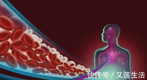 手术治疗|一旦形成就堵塞血管!血栓能自溶?能冲走?真正溶栓方法只有2种