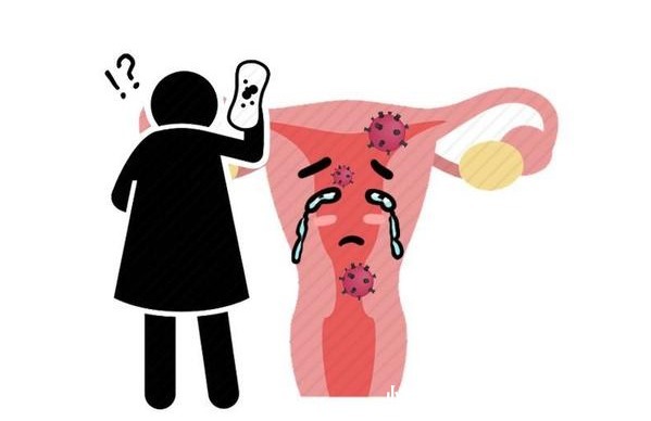 颈部|时不时的偏头疼，究竟什么原因？医生告知4个因素你可能想不到