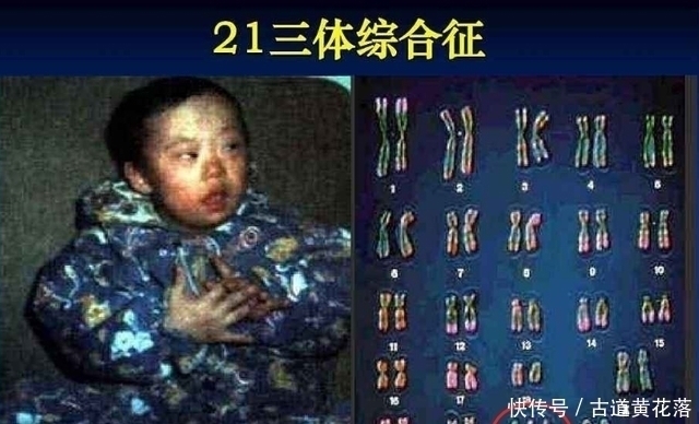 孕期|怀胎十月“注意事项”一览表,孕妈收藏备用,愿宝宝顺利出生!